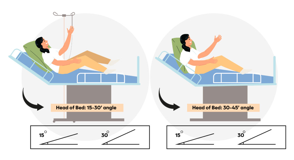 High Fowlers Position