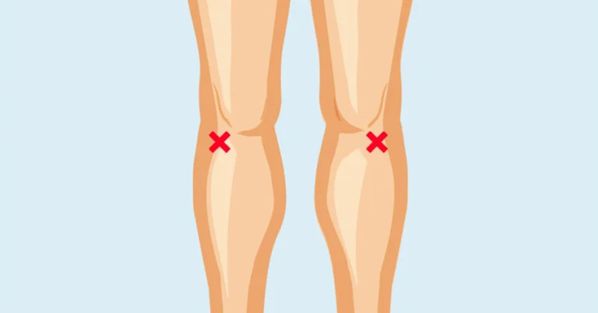 Popliteal Pulse Point (Behind the knee)